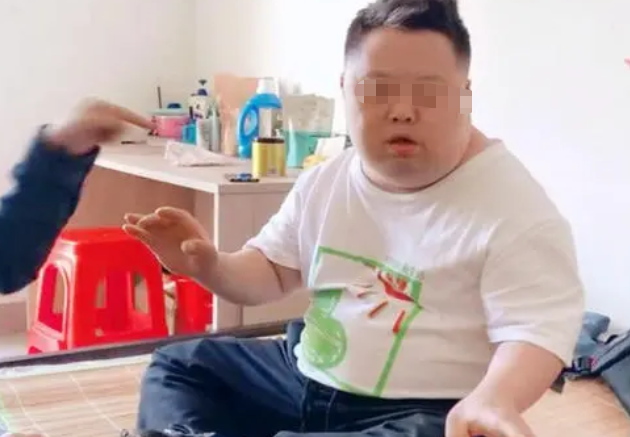 唐氏综合症_唐氏综综合图片_囤积症对应的是什么症