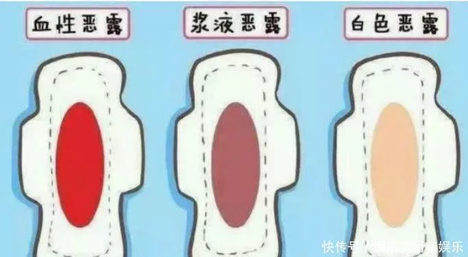 产后恶露