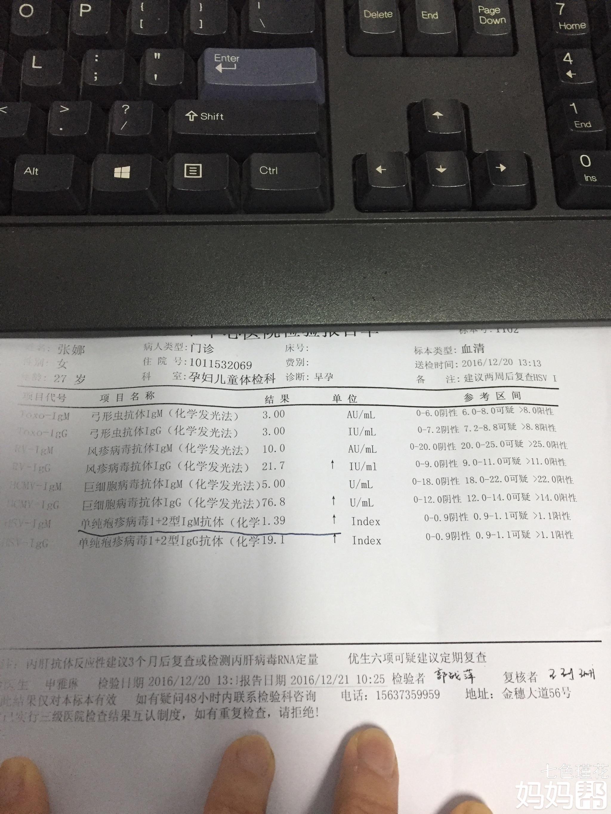 单纯疱疹病毒指标高