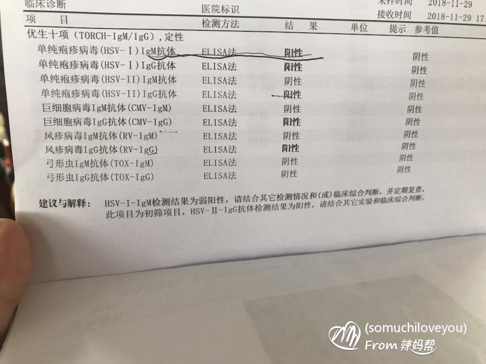 呼吸道病毒 单纯疱疹_单纯疱疹病毒感染_单纯疱疹病毒
