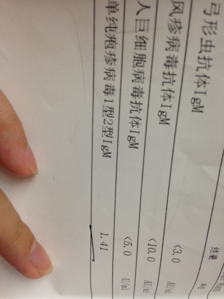 抗单纯疱疹病毒1型2型 IgM  阳性