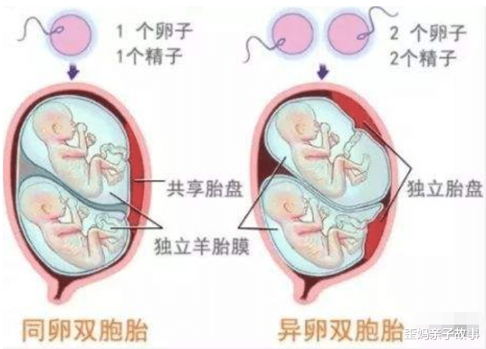 多胎妊娠_妊娠足月胎停的原因_足月妊娠胎心率是多少