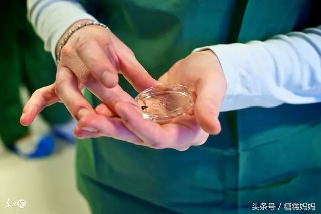 怎么生双胞胎