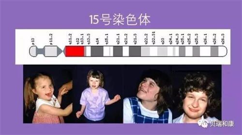 拖延症的自我疗法:七周扫除拖延症_唐氏总和症_唐氏综合症