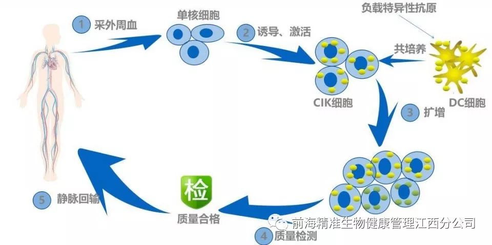 nk细胞_car–nk细胞_nk细胞治疗