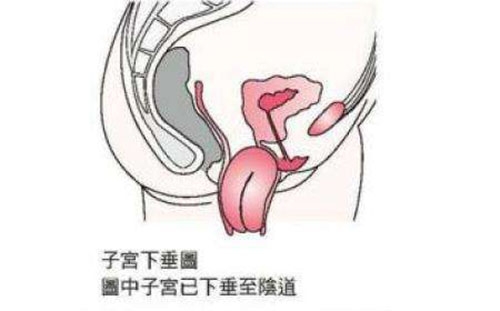 产后恶露不尽_产后恶露_顺产产后恶露多久干净