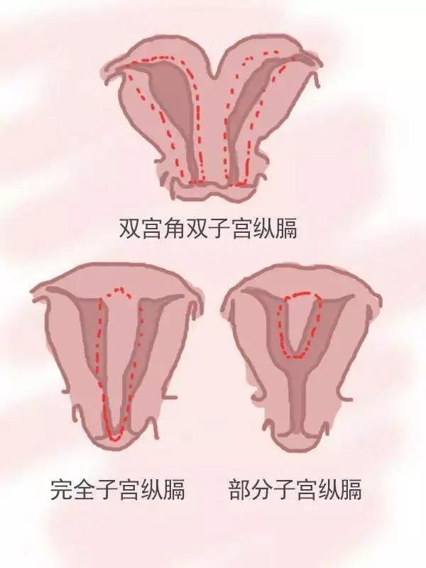 宫外孕的hcg值下降到多少才正常_hcg值范围是多少正常_hcg正常值