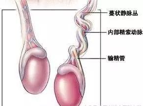 睾丸扭转_睾丸扭转/复位_急性睾丸扭转