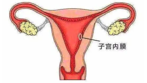 闭经,子宫偏小内膜0.5_始基子宫会长内膜吗_子宫内膜薄