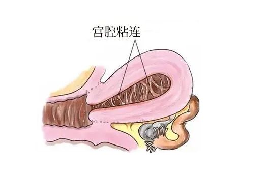 宫腔镜检查?_复兴医院宫腔镜检查_宫腔环境检查