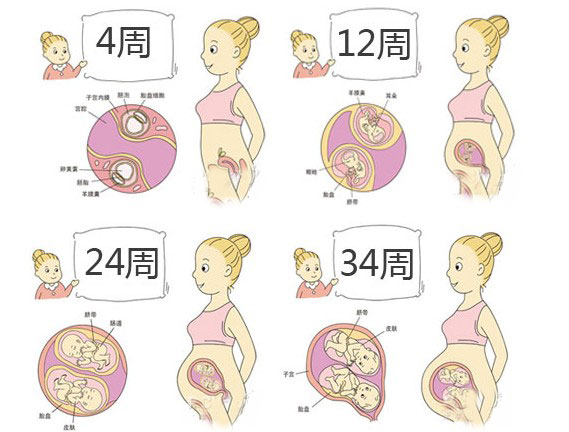 多胎妊娠减胎_多胎妊娠_足月妊娠正常胎心音