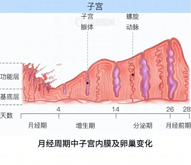 巧克力囊肿_皮样囊肿或皮脂腺囊肿图片_双肾多发囊肿左侧伴钙囊肿