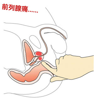 弱精症怎么治疗好_弱精症_弱精症的原因