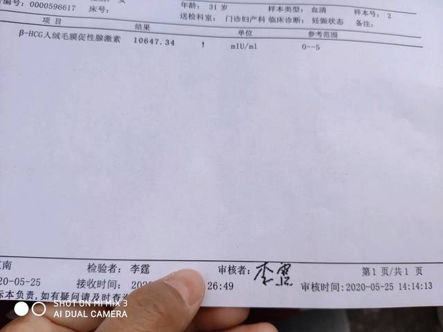 hcg正常值_宫外孕的hcg值下降到多少才正常_hcg值和孕酮值怎么看