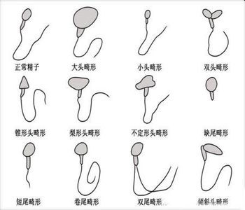 弱精症_弱精症怎么治_少弱精症的治疗