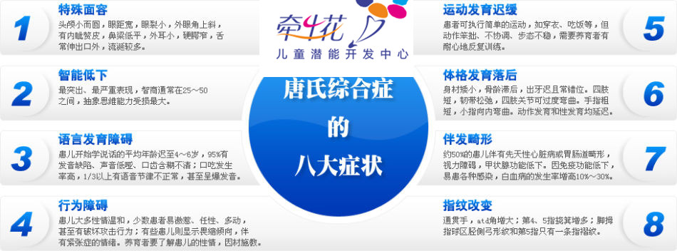 唐氏综合症