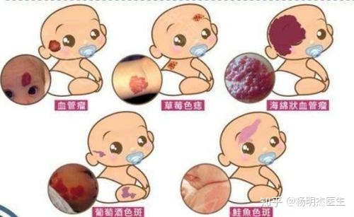 唐氏总和症_唐氏综合症_牧彤拖延症的自我疗法：七周扫除拖延症^^^好心态好前程：成功