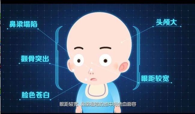 地海中贫血有哪些症状_地海中贫血有什么症状_地中海贫血