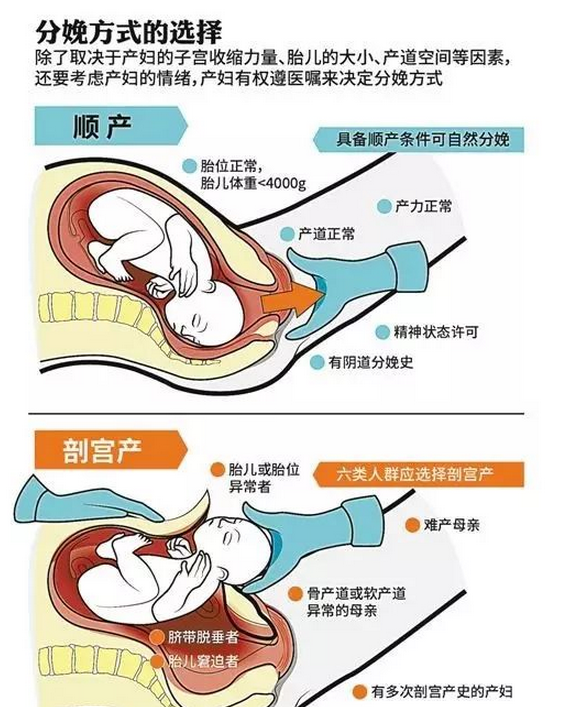 侧切_顺产侧切_顺产侧切伤口