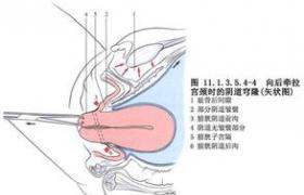 宫腔镜检查_试管前宫腔镜检查_什么是宫腔镜检查