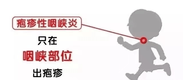 复发性单纯疱疹_单纯疱疹性病毒_单纯疱疹病毒