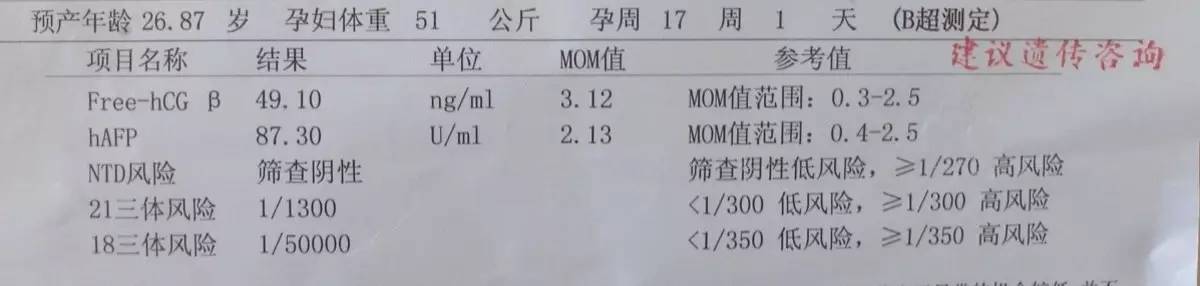 唐氏综合筛查是什么意思_囤积症对应的是什么症_唐氏综合症