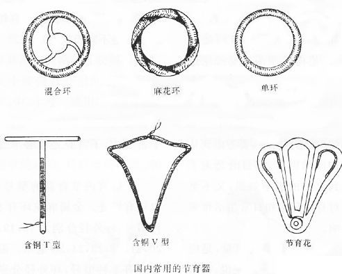 子宫腺肌症症如何受孕_子宫肌腺症 子宫腺肌症_子宫腺肌症