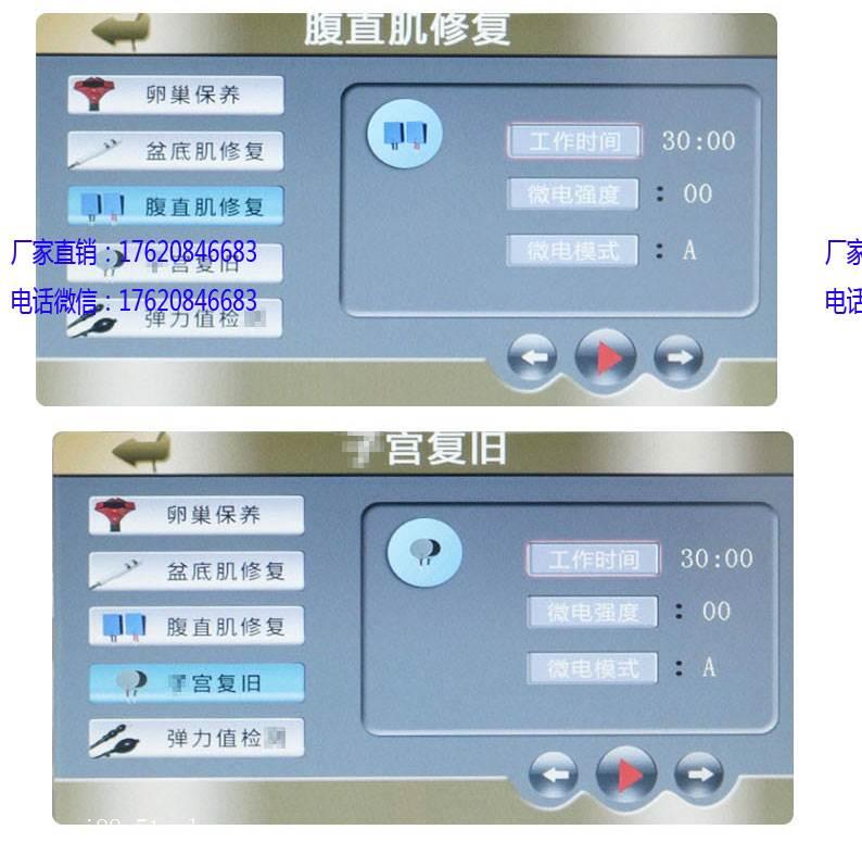 盆底肌修复仪生产厂家