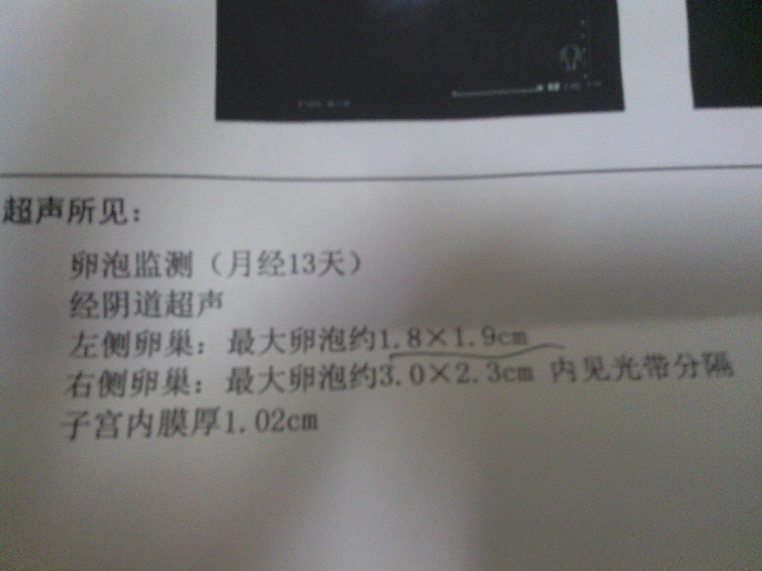 窦卵泡计数_卵泡期用洗手液影响卵泡发育吗_卵泡与卵泡囊肿