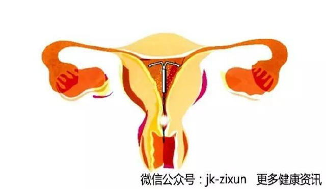 黄体期_妊娠黄体和月经黄体_卵泡期黄体生成素偏低