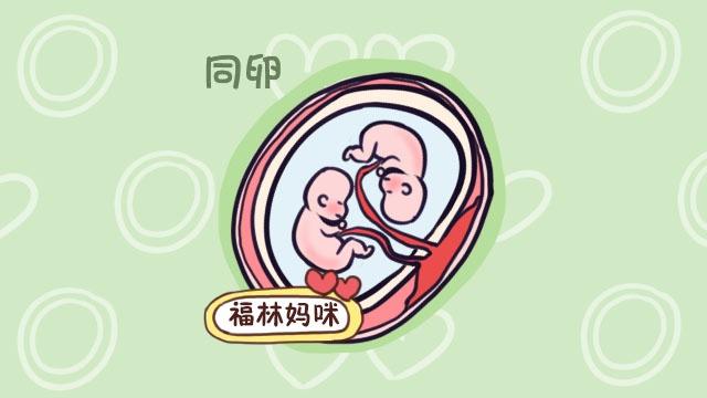 同卵双胞胎