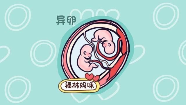 同卵双胞胎
