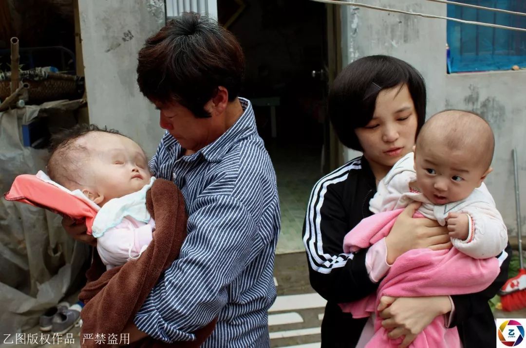怎么生双胞胎