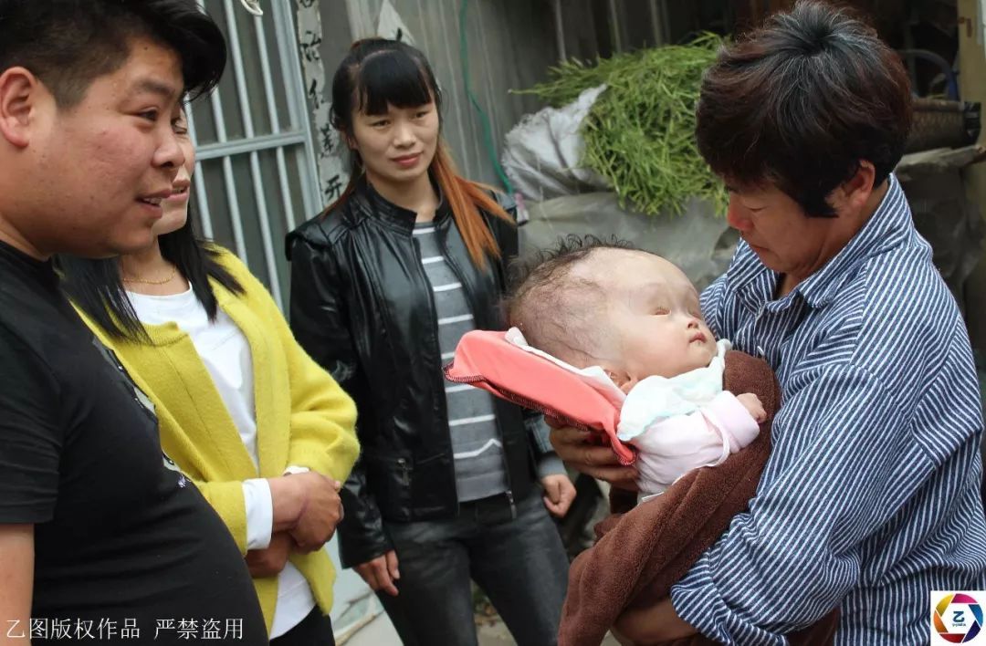 怎么生双胞胎