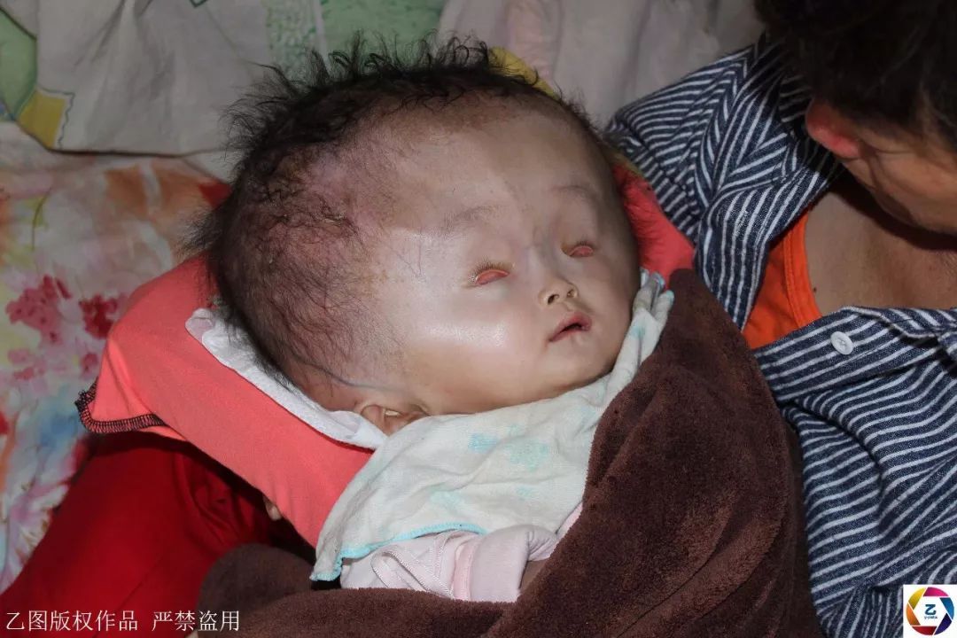 怎么生双胞胎