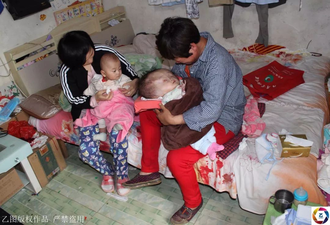 怎么生双胞胎