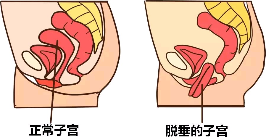 小月子月子餐_小月子_小月子要做多久