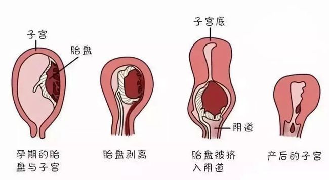 产后恶露膏_产后恶露反复_产后恶露