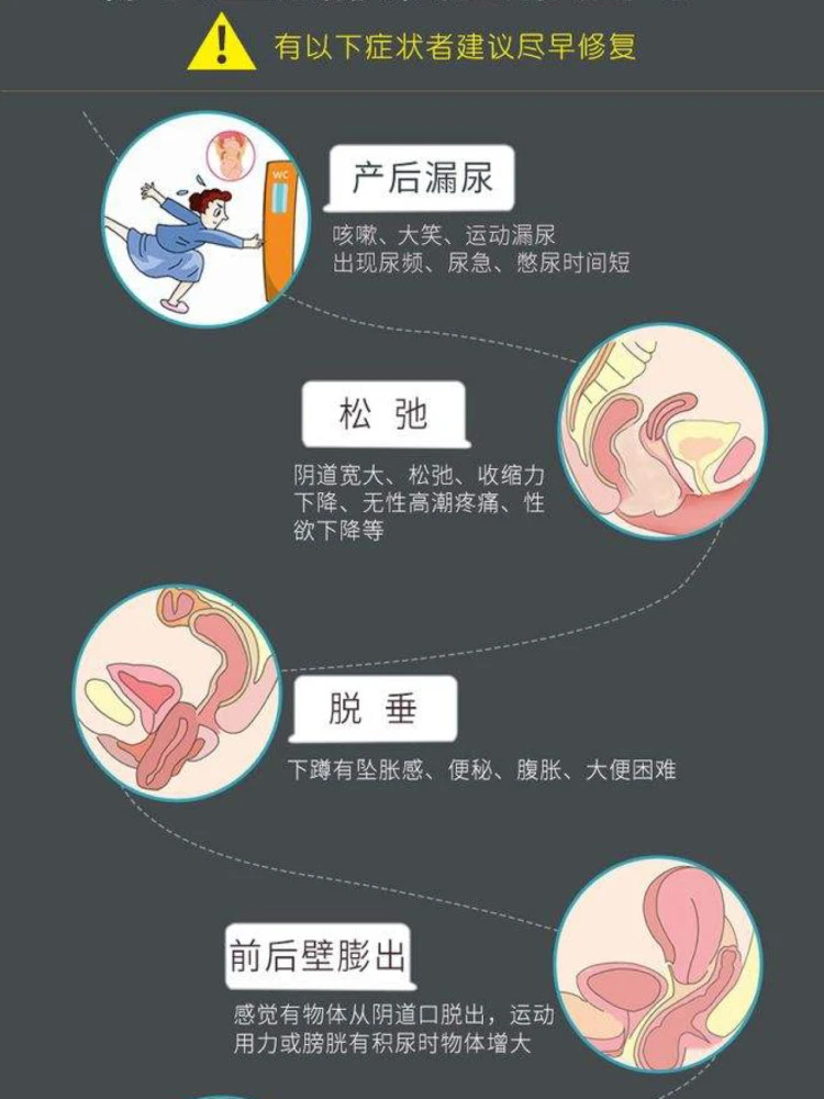 盆底肌修复