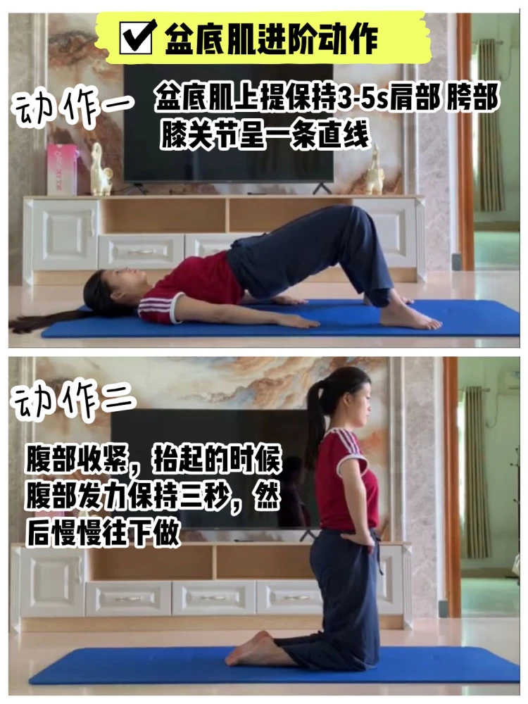 盆底肌修复