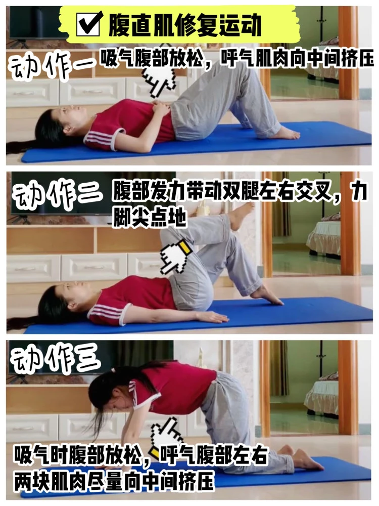 盆底肌修复