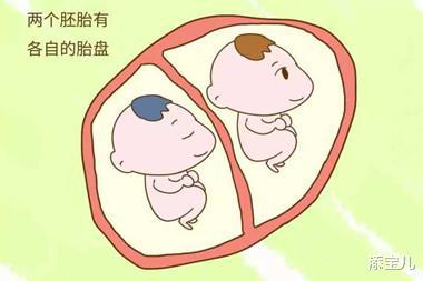 多胎妊娠_多胎妊娠减胎_足月妊娠正常胎心音
