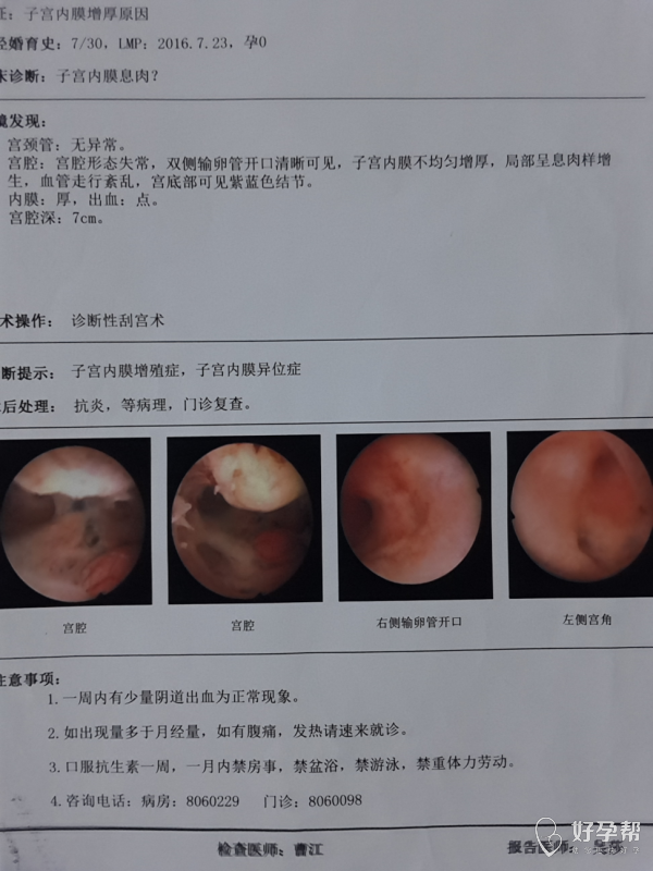 输卵管造影_输卵管b超造影和x造影_输卵管超声造影疼不疼