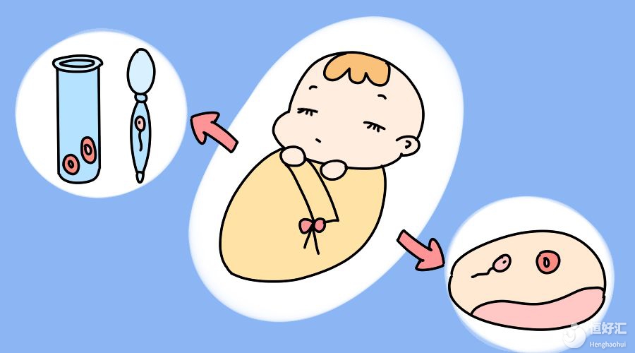 辅助生殖_辅助生殖哪个医院便宜_辅助生殖医院哪个便宜