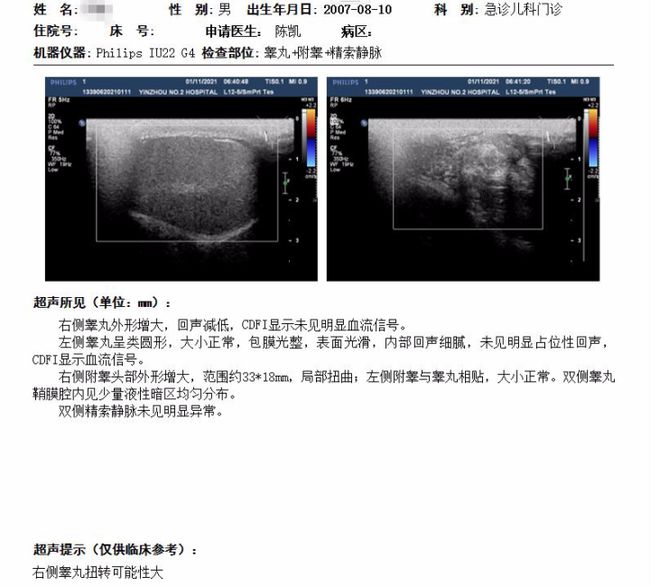 睾丸扭转原因_睾丸扭转手术_睾丸扭转
