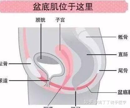 盆底肌修复
