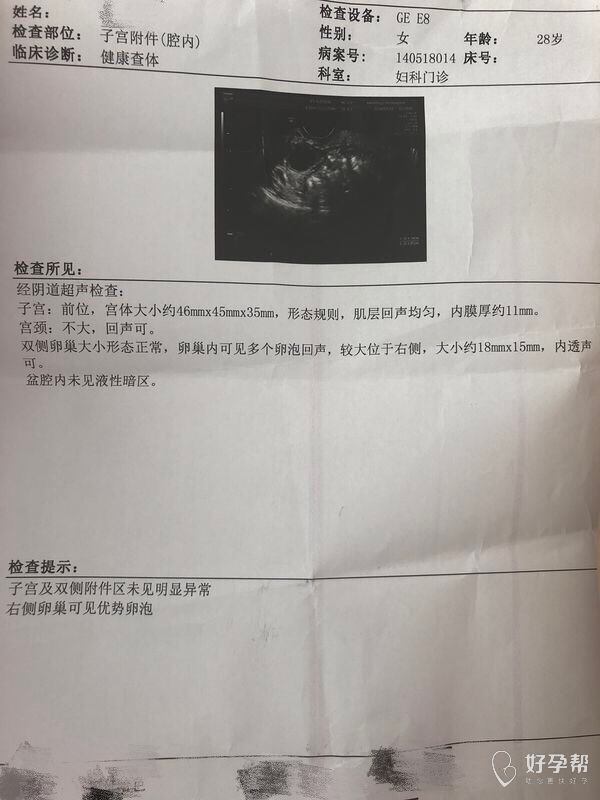 穿刺大卵泡,小卵泡能长大吗_窦卵泡计数_卵泡与卵泡囊肿