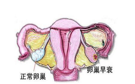 穿刺大卵泡,小卵泡能长大吗_窦卵泡计数_卵泡与卵泡囊肿
