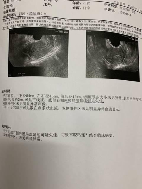 宫腔粘连_重度宮腔粘连图片_宫口粘连怎么治疗