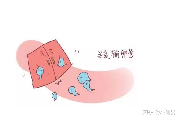 输卵管造影